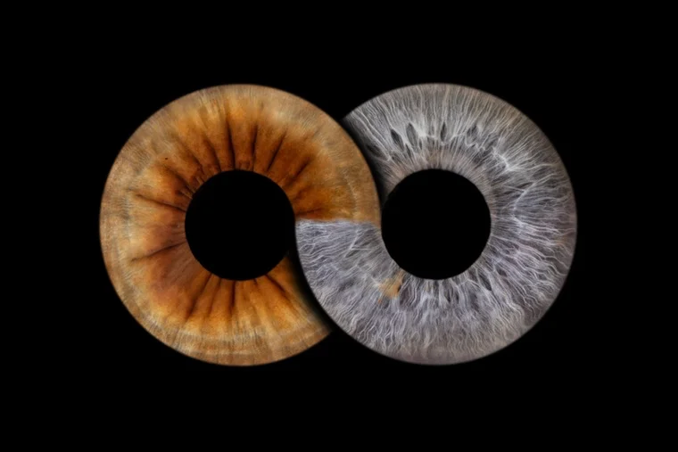 Unsere Augen – jetzt Kunstwerke auf Acryl.