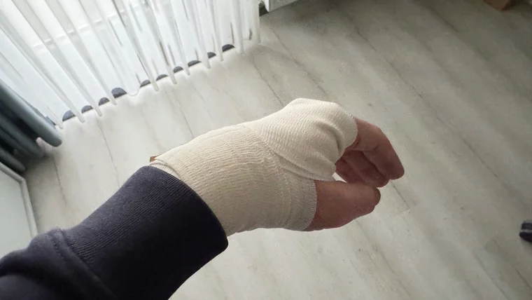 Verband drauf – sieht schlimmer aus, als es ist.